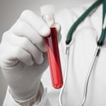 Possible Ways How To Fight To Beat A Texas DWI/DUI Blood Test Case