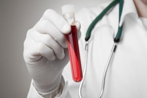 How To Fight a DUI Blood Test
