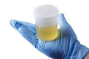 Challenging BAC Urine Test Results
